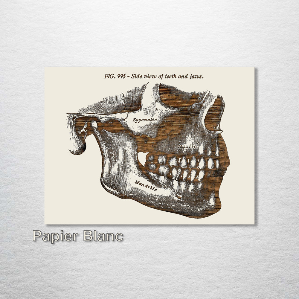 Gray‚s Side Jaw - Fire & Pine
